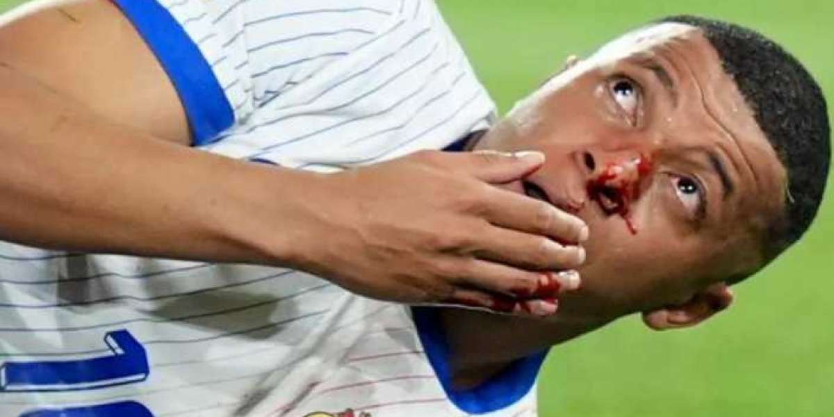 Francia "non sa" se Mbappe potrà affrontare l'Olanda